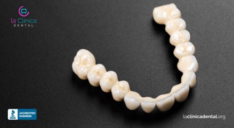 Ventajas y desventajas de las prótesis dentales y tipos que existen por especialistas de La Clínica Dental